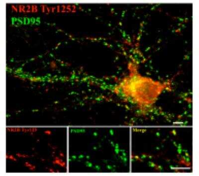 Immunohistochemistry: NMDAR2B [p Tyr1252] Antibody [NB300-292]